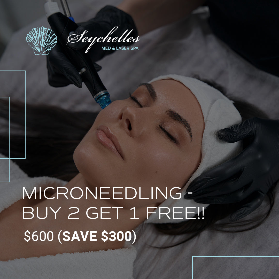 Microneedling - Buy 2 Get 1 Free!!